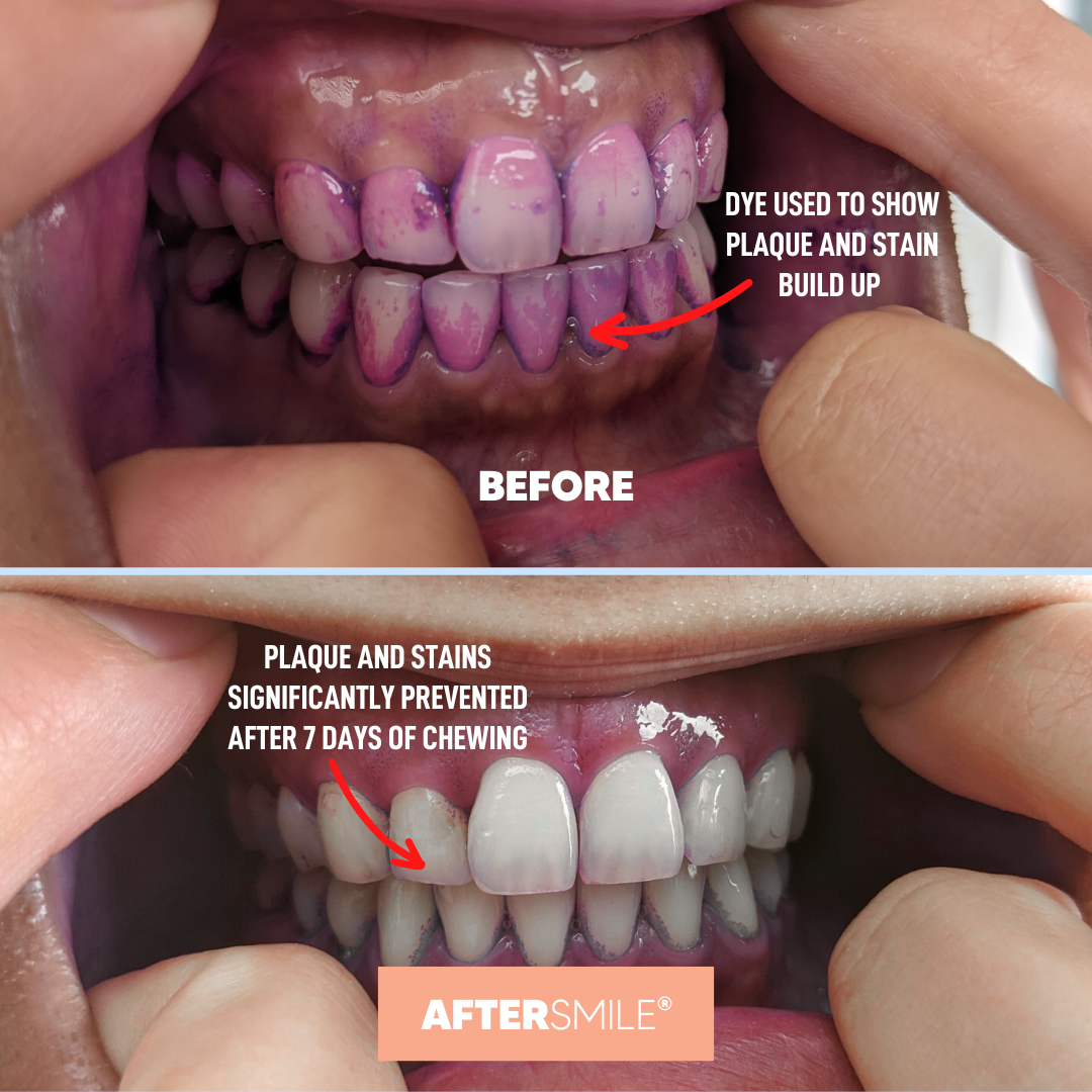 Whitening Chewing Gum - 10 packets  (120 pieces) EXCLUSIVE OFFER